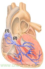 檢測并區分心臟起搏偽像